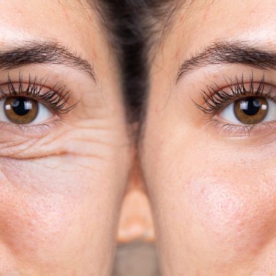 A young woman shows the before and after results of successful b