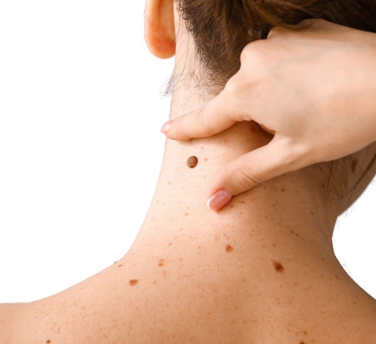 dermatochirurgie2-small